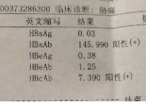 復(fù)聽在醫(yī)學(xué)上的意思是什么 醫(yī)生說的陽性和陰性有什么區(qū)別